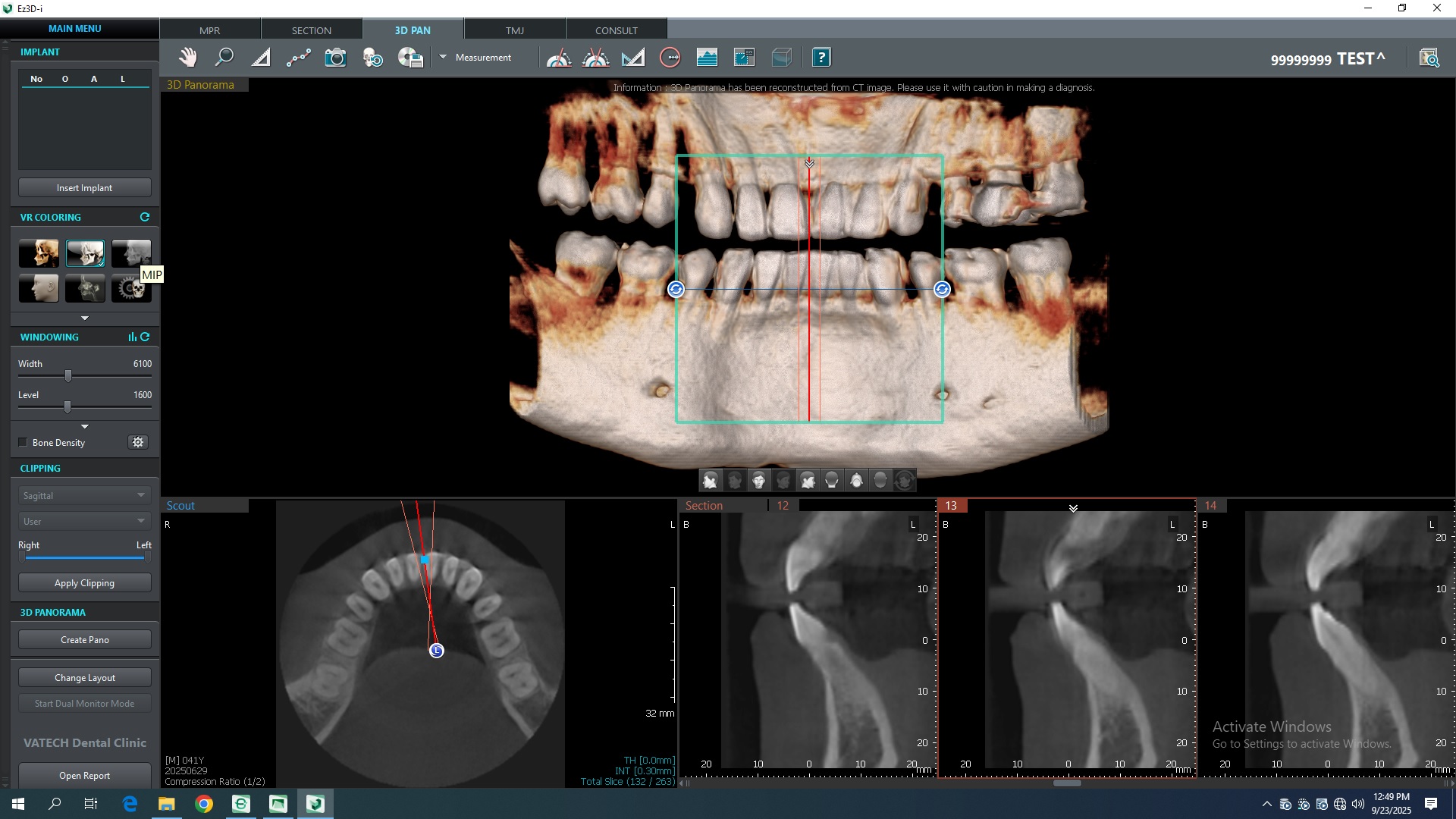Ortopantógrafo Digital 3D PaX-i3D